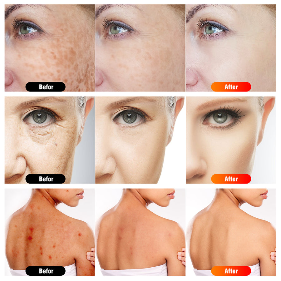 7 in 1 Portable Light Therapy Lamp for Face and Body