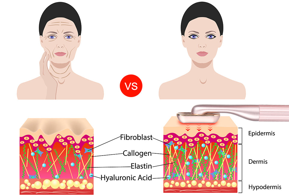 Using Red Light Therapy Usuie Red Light Therapy Skincare Wand