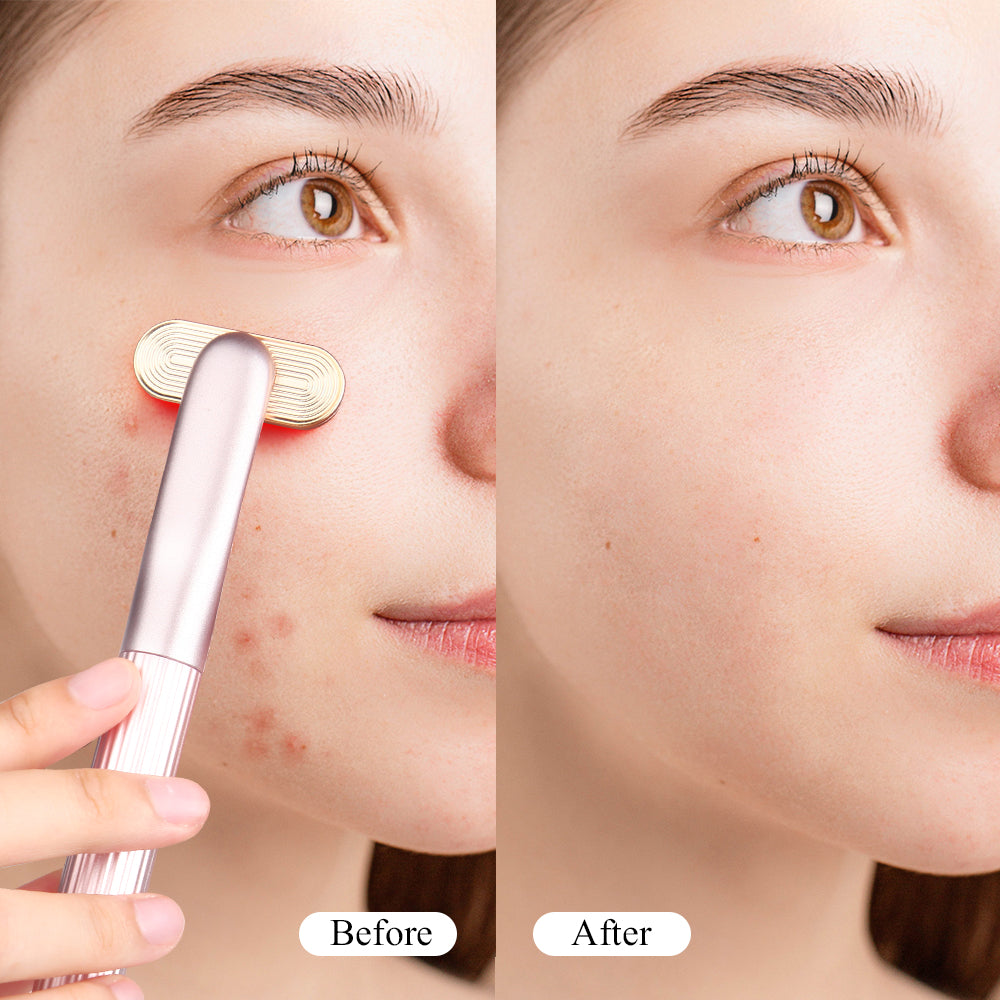 Usuie Red Light Therapy Skincare Wand - Usuie